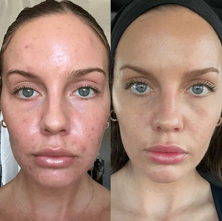 Gel Exfoliant Delicat cu Enzime de Portocală